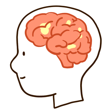 거의 활성화되지 않은 뇌 사진