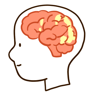 조금 활성화된 뇌 사진